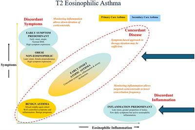 Pre-asthma: a useful concept? A EUFOREA paper. Part 2—late onset eosinophilic asthma